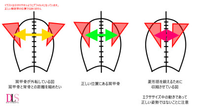 猫背を直せ ダンサーが知っておきたい菱形筋について Dancer S Life Support Com