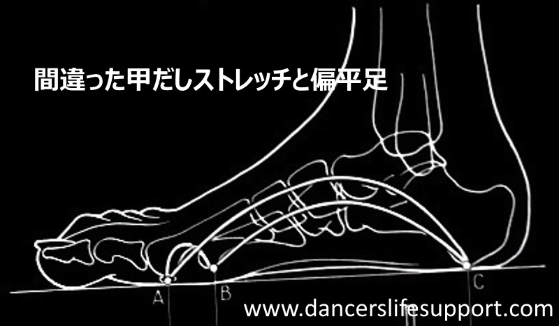 間違った甲だしストレッチと偏平足 | Dancer's Life Support.com